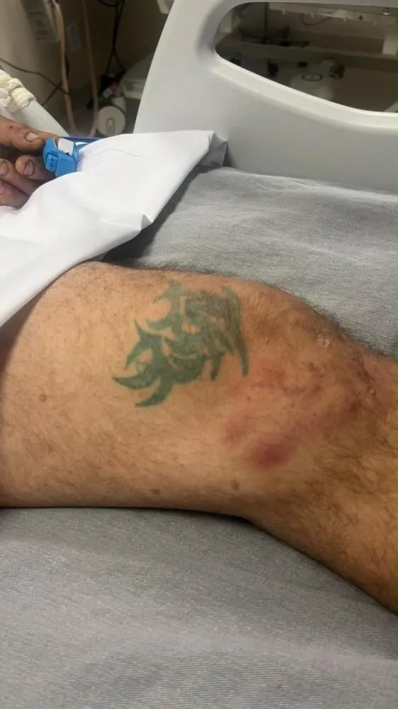 HUOP pede ajuda para identificar homem internado na UTI em Cascavel