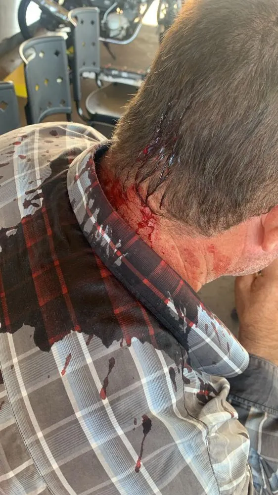 Homem é agredido com golpe de nunchaku em posto de combustíveis