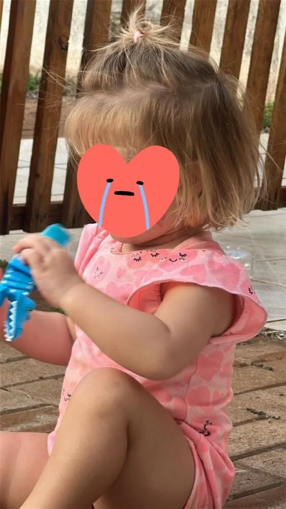 PM abre caminho e ajuda a salvar criança atacada por cão em Cascavel