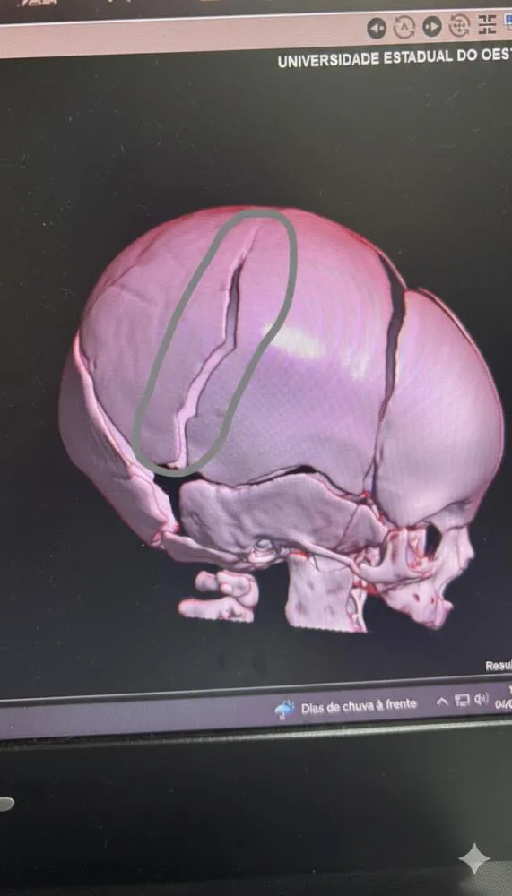 Polícia Civil investiga agressão de mãe contra bebê em Santa Tereza do Oeste