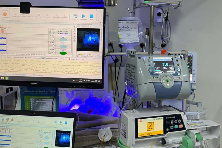 Hospital Regional do Sudoeste inicia testes da UTI Neonatal Neurológica, pioneira na rede