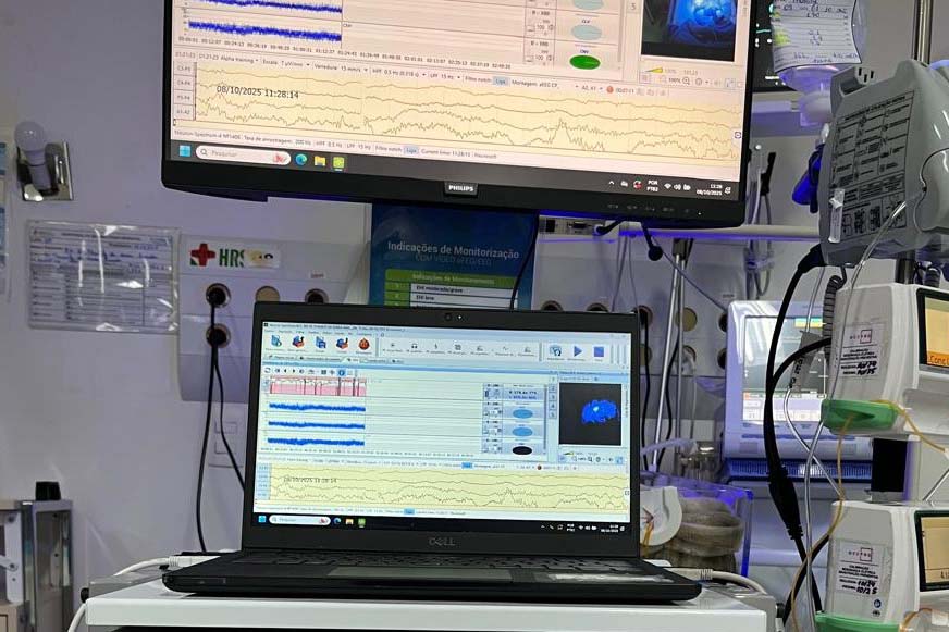 Hospital Regional do Sudoeste inicia testes da UTI Neonatal Neurológica, pioneira na rede