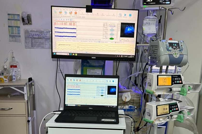 Hospital Regional do Sudoeste inicia testes da UTI Neonatal Neurológica, pioneira na rede